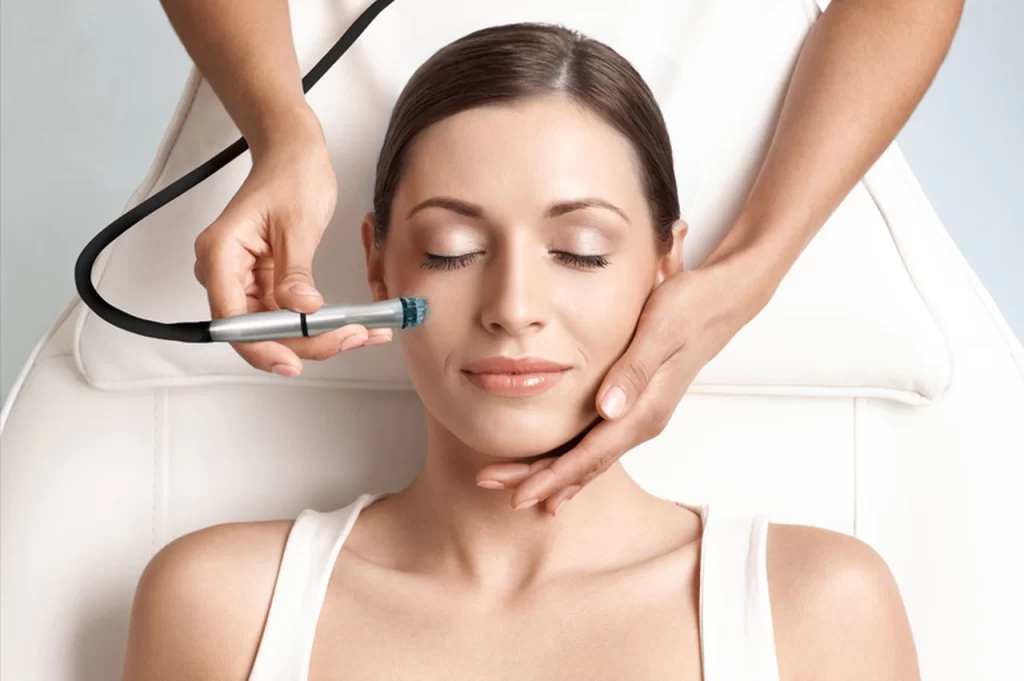 microdermabrasion facial in Huntington Beach, CA